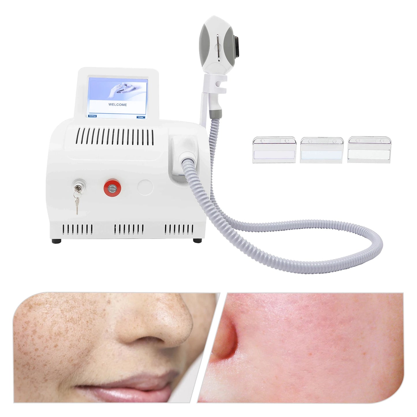 Laser Hair Removal RF Skin Rejuvenation Machine