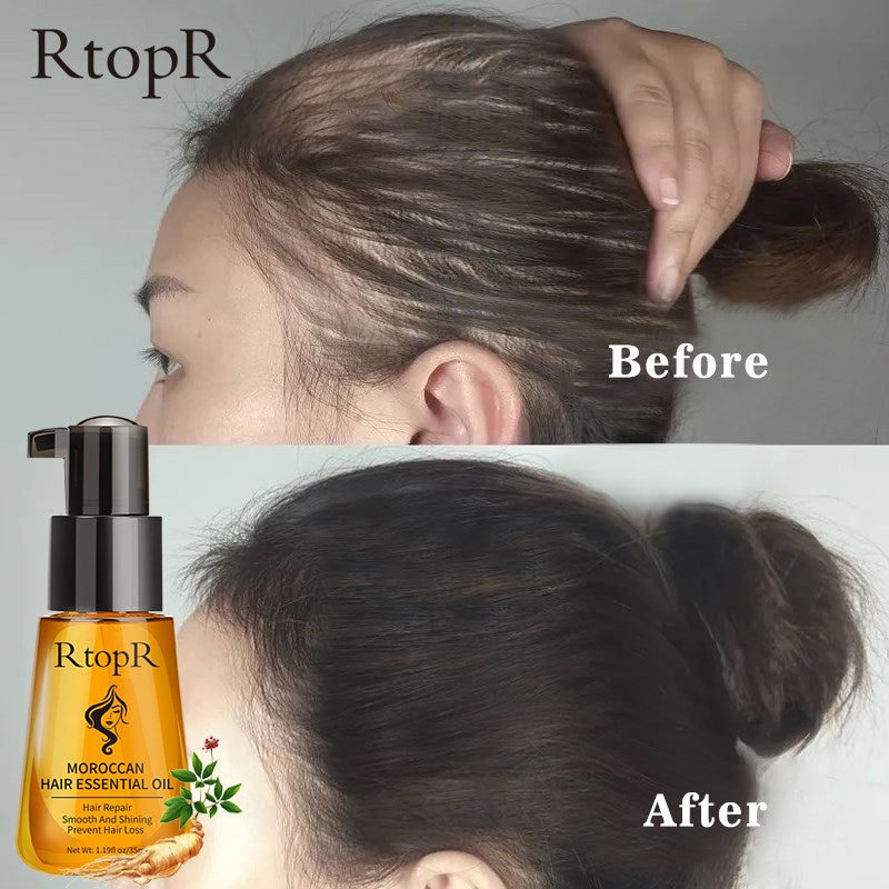 Moroccan Prevent Hair Loss  Hair Growth Essential Oil - peterkaczconnect