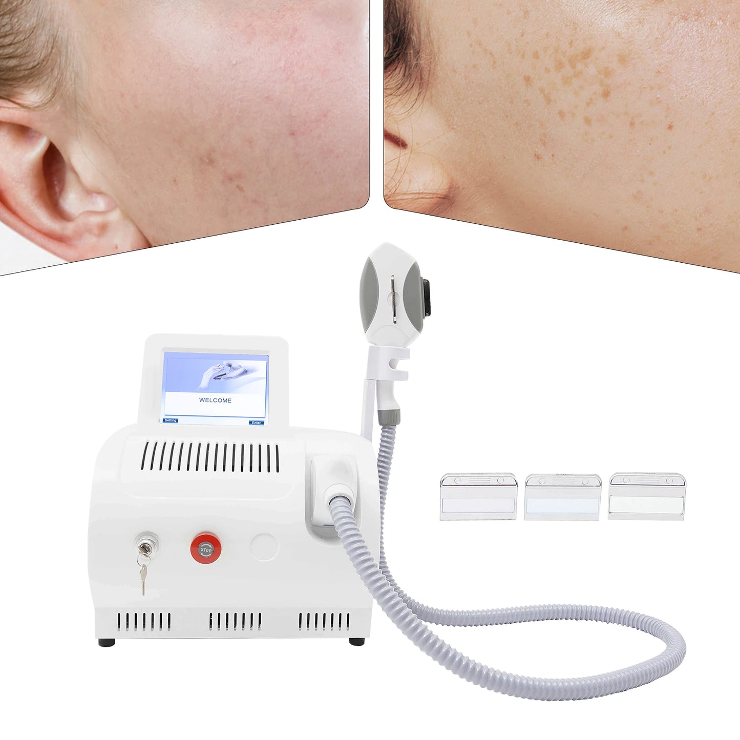 Laser Hair Removal RF Skin Rejuvenation