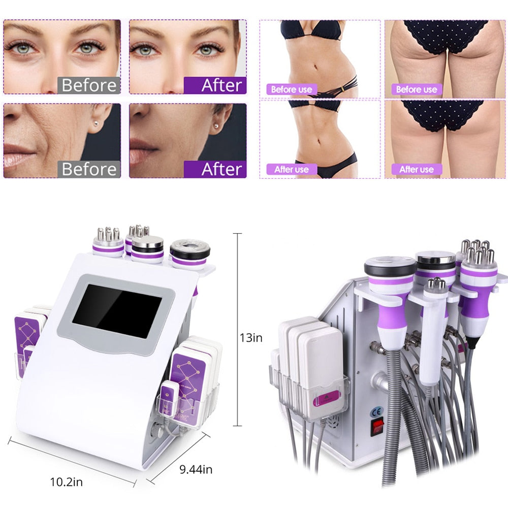 Skin Tightening Vacuum RF Machine for Salon Home Use - peterkaczconnect