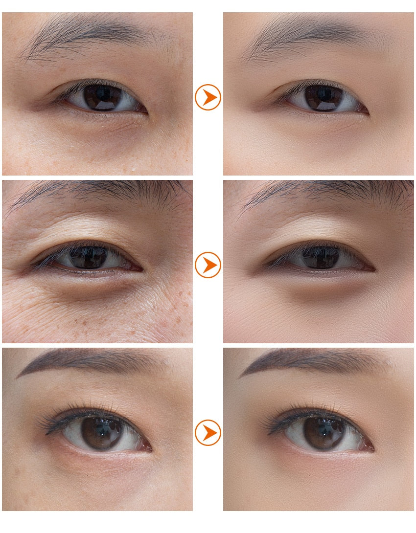 Eye Patch Seaweed Eye Gel Remove Dark Circles - peterkaczconnect