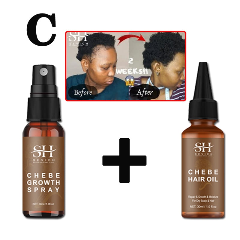 Alopecia Treatment Oil Hair Growth Spray Hair Loss Treatment - peterkaczconnect