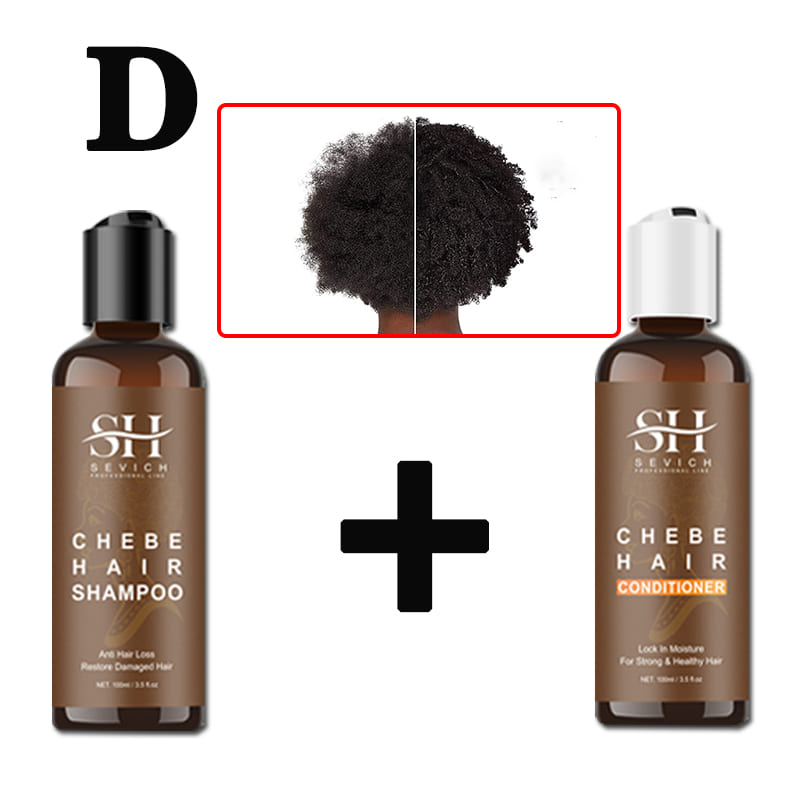 Alopecia Treatment Oil Hair Growth Spray Hair Loss Treatment - peterkaczconnect