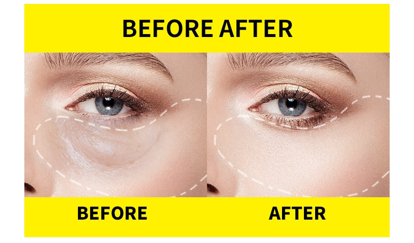 Eye Patch Seaweed Eye Gel Remove Dark Circles - peterkaczconnect